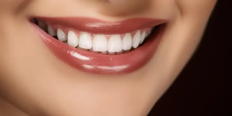 Różnice między licówkami porcelanowymi a kompozytowymi