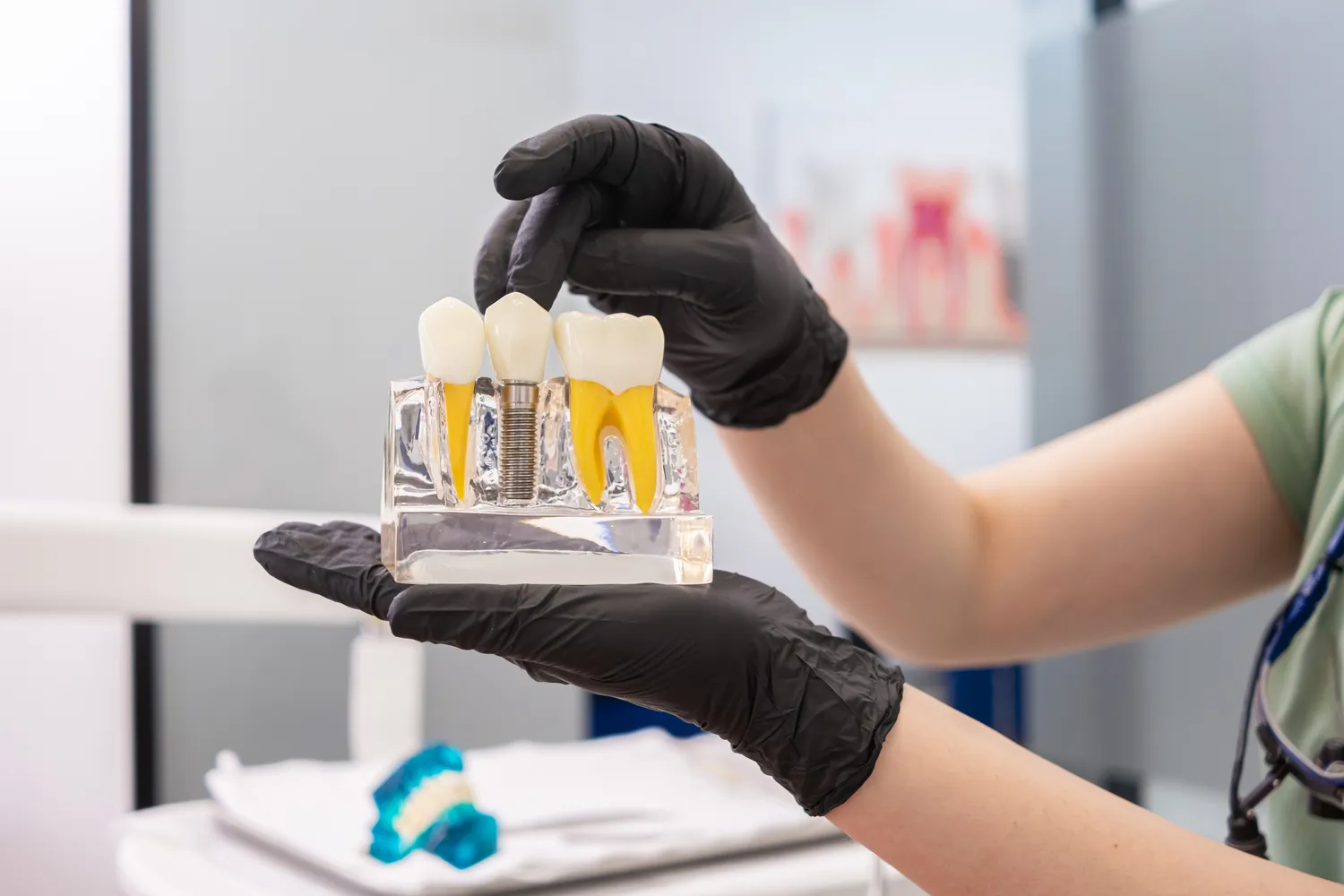 Ile trwa odbudowa kości pod implanty?